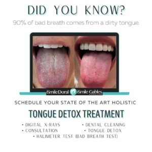 Read more about the article Tongue Detox Treatment in Coral Gables, Doral and Miami Florida